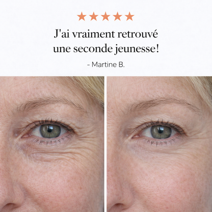 Baume contour des yeux hyper puissant contre les cernes et les poches