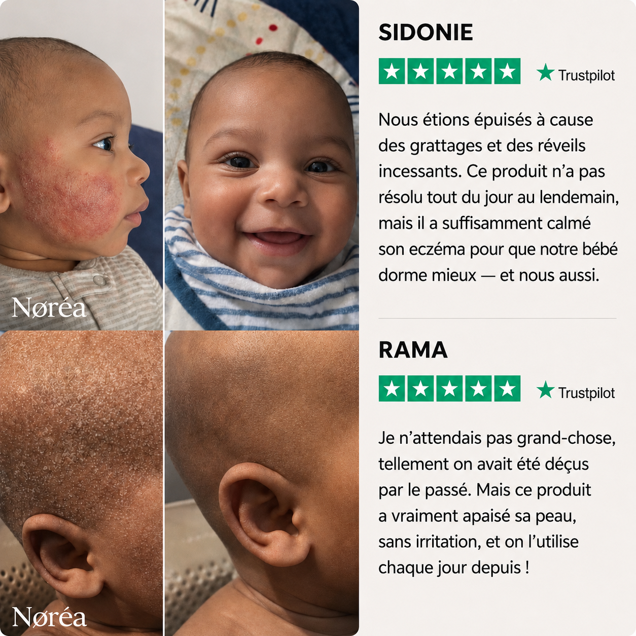 Crème Apaisante au Miel contre l'Eczéma
