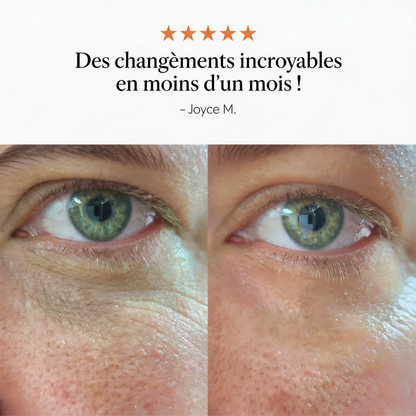 Baume contour des yeux hyper puissant contre les cernes et les poches