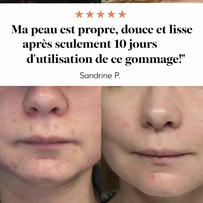 Gommage visage ultra nettoyant & revitalisant